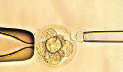 体外受精 IVF-ET